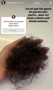Foto mostrando a queda de cabelo de Lucy ramos